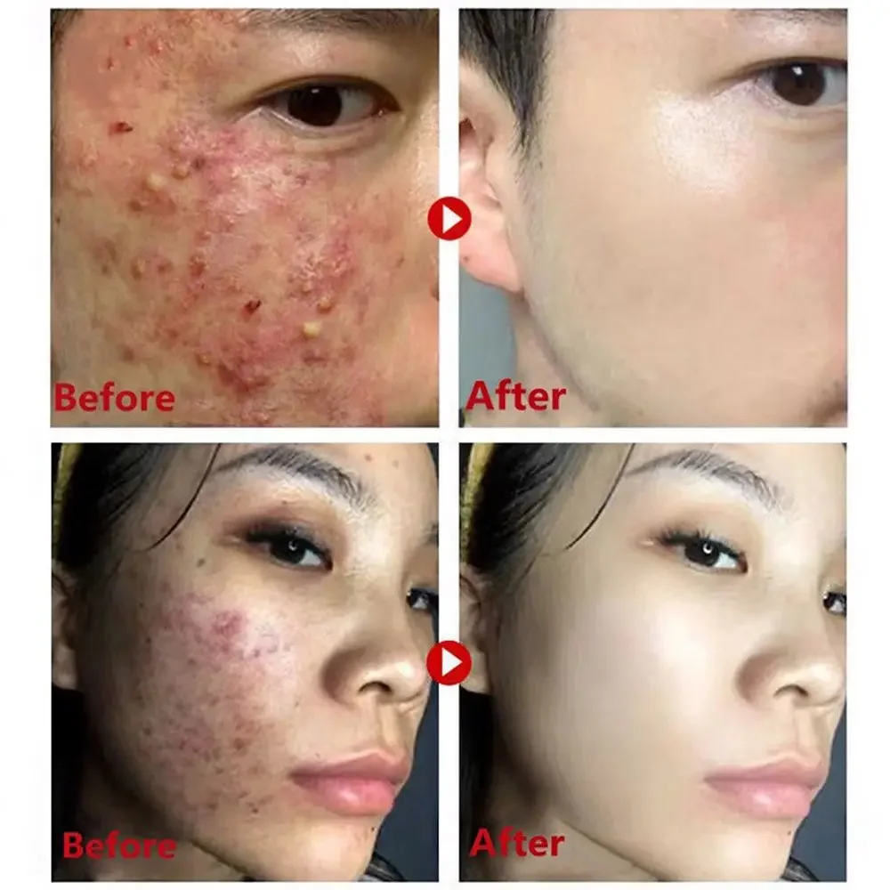Green Tea Mask Stick Remove Bl - огляд і ціна Green Tea Cleansing Clay Mask