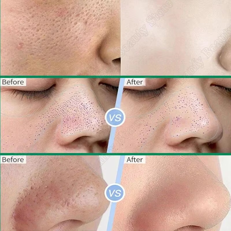 Salicylic Acid Pore Clearing C - огляд і ціна Salicylic Acid Blackhead Remover